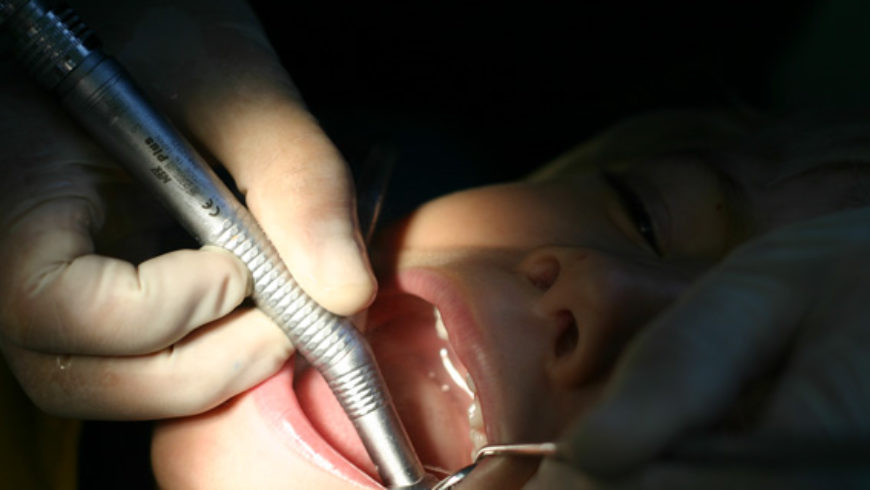 Consentimiento informado para implantes dentales